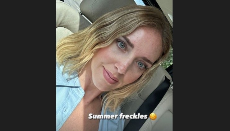 chiara ferragni selfie lentiggini pelle estate 