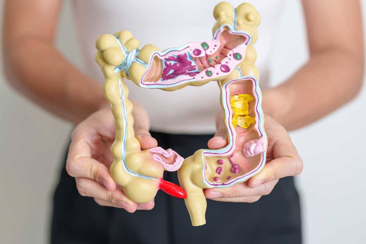 I sintomi del tumore del colon-retto